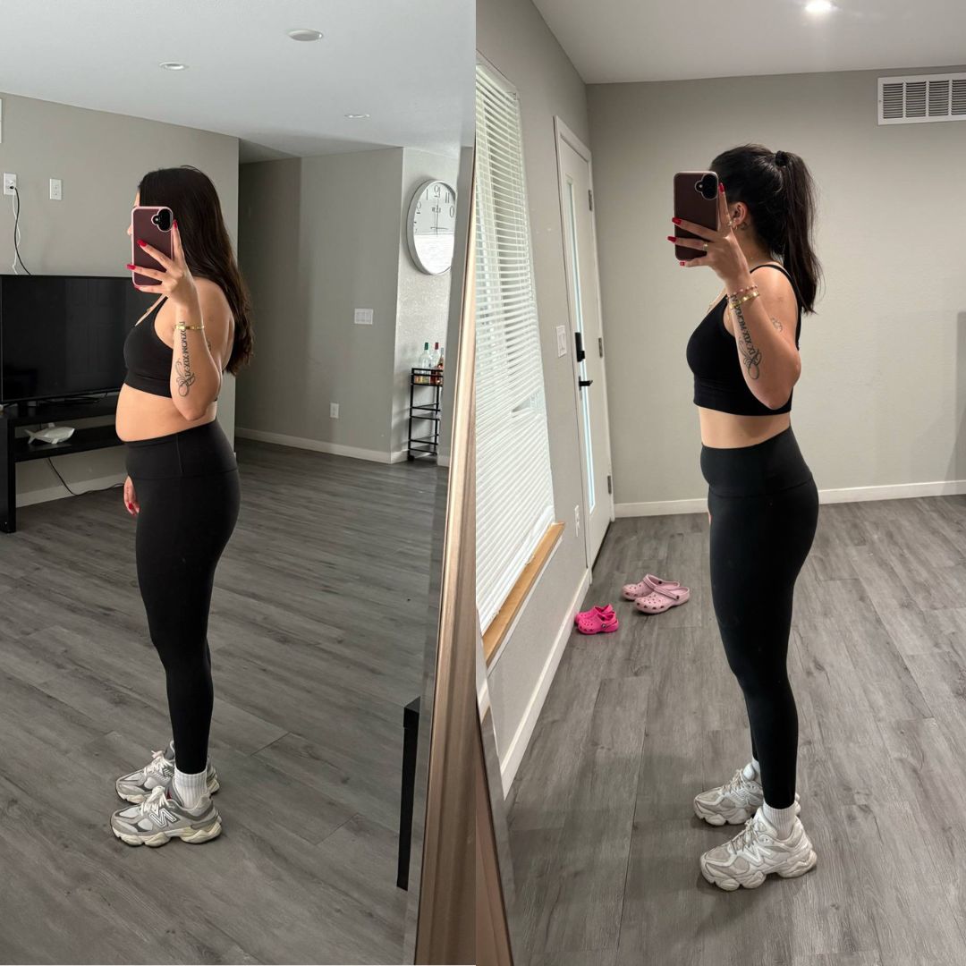 Denver body sculpting client transformation showing a flatter abdomen and toned arms.
